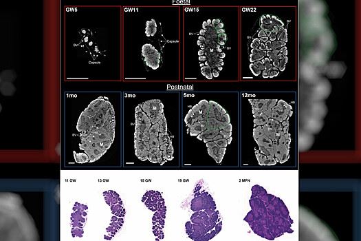 Nature: получены первые объемные изображения человеческого тимуса